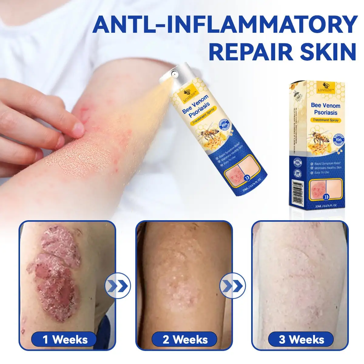 PsoriaHeal psoriasis Spray - Image 8