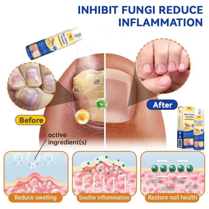 PsoriaHeal psoriasis Spray - Image 9