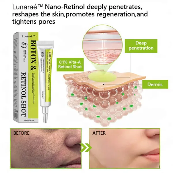Botox & Retinol Shot - Image 12