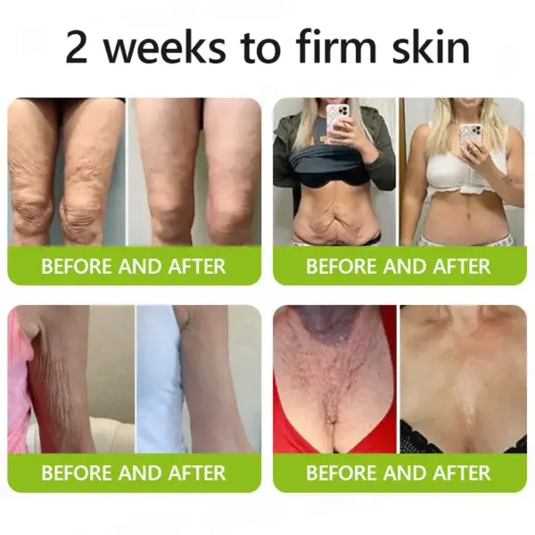 Botox & Retinol Shot - Image 13