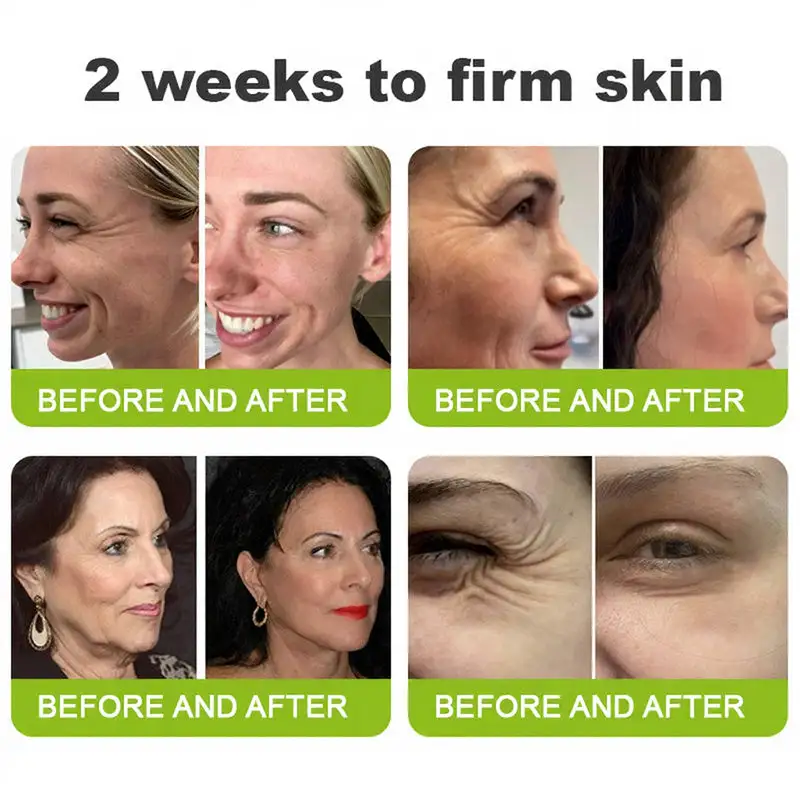 Skin Tightening & Vita-A Retinol Retinol shot Anti-Wrinkle Firming Tightening cream - Image 6