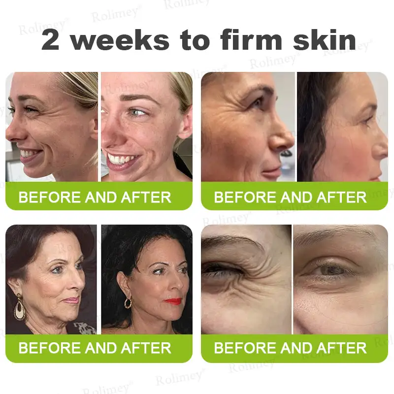 🇺🇸 Made and shipped from the USA Botox & Vita-A Retinol Shot Wrinkle-Lift Tightening cream - Image 6