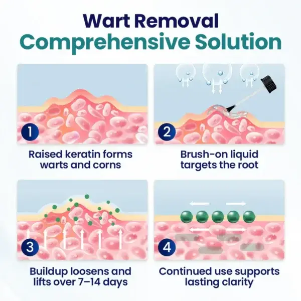 WartLift Corn Removal Liquid - Image 8