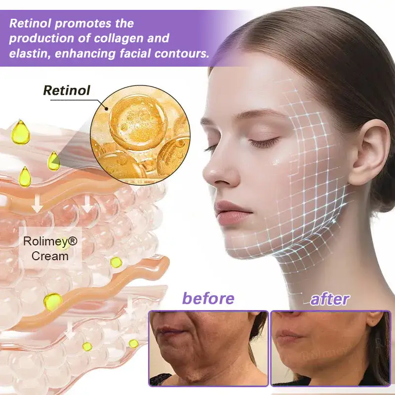 NAD+ Retinol Firming & Lifting Cream(30ml) - Image 9