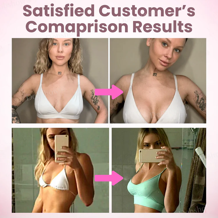 Breast Enhancement Nano Patch - Image 2
