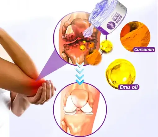Pain Relief Gel With Turmeric Emu Oil for Arthritis Joint Support - Image 4