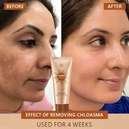 Whitening and Spot-Removing Face Mask Suitable for face and body - Image 5