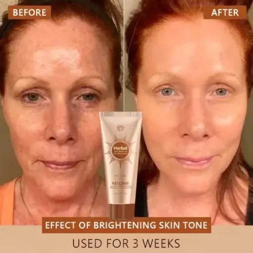 Whitening and Spot-Removing Face Mask Suitable for face and body - Image 6