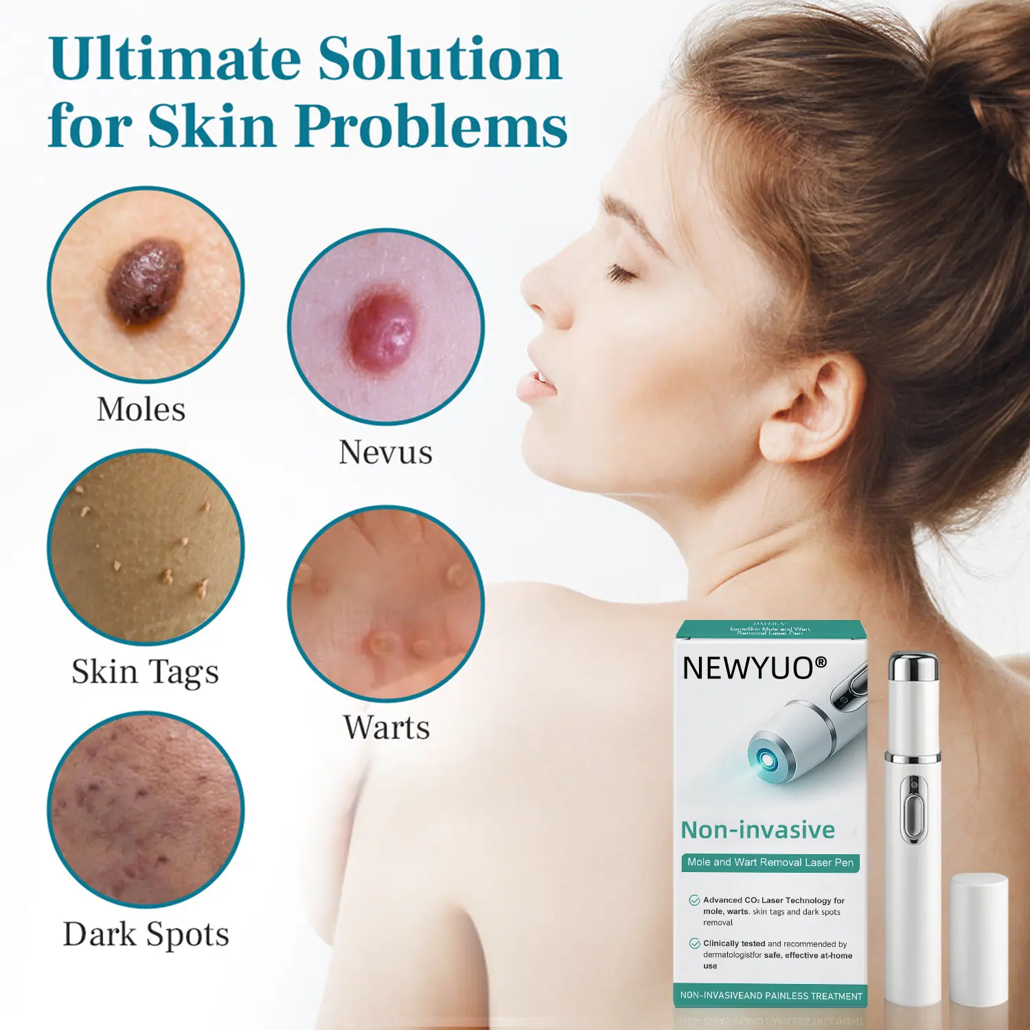 Non-invasive Mole and Wart Removal Laser Pen - Image 9