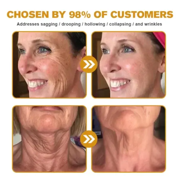 New Year Sale Botox Bee Venom Wrinkle Removal Cream - Image 6