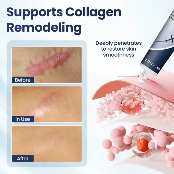 DERMALUX Texture Repair Gel - Image 6