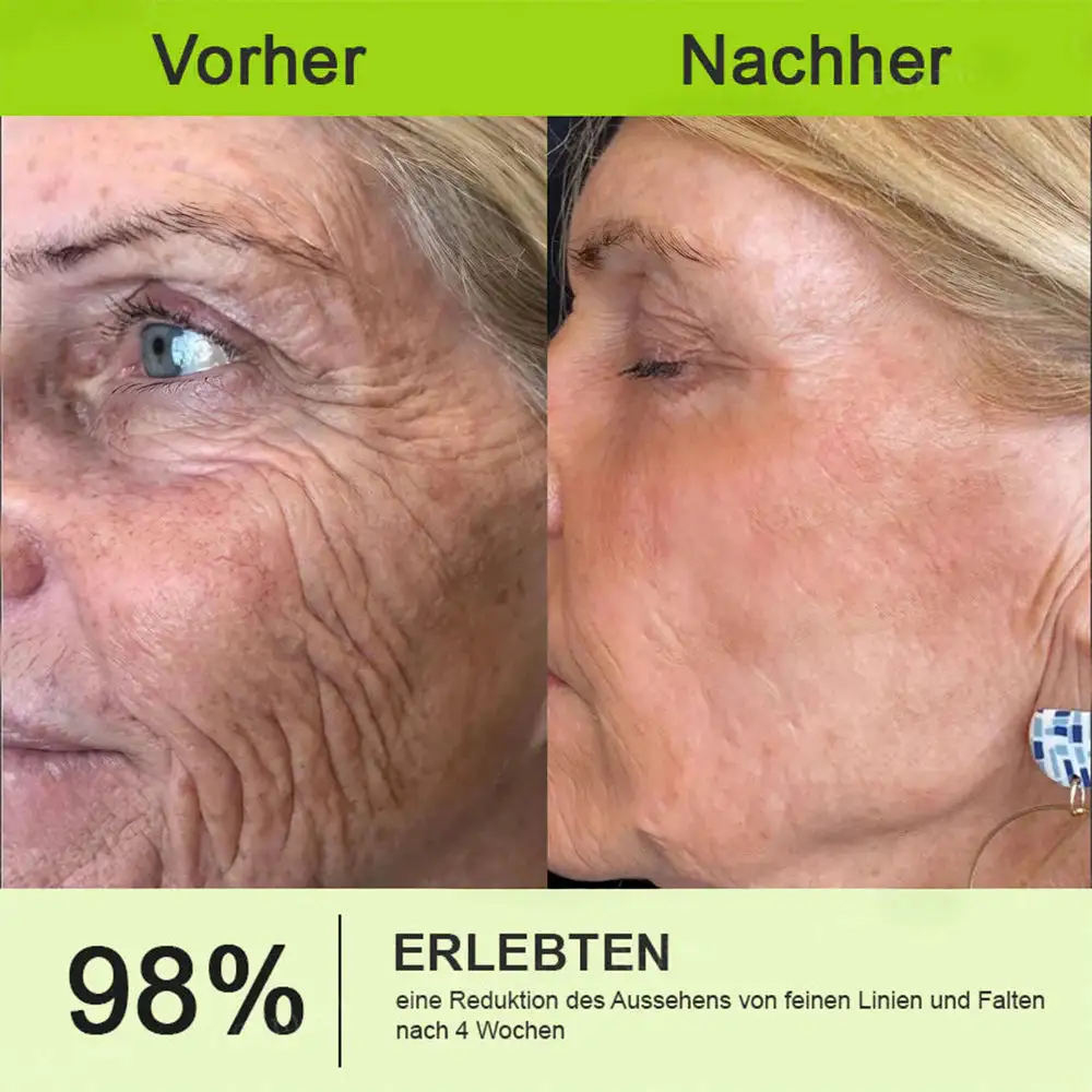 NESLEMY ™ Botox & Vita-A Retinol Shot Wrinkle Lift Firming Cream - Image 12