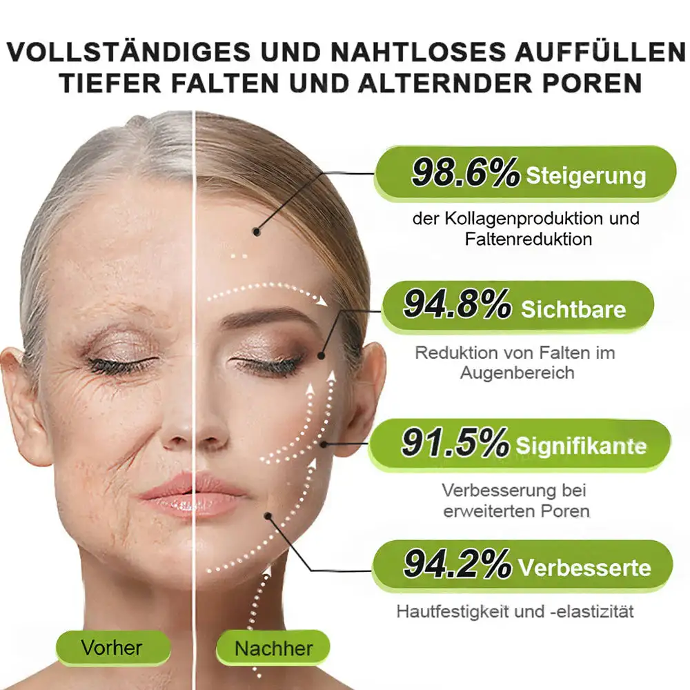 NESLEMY ™ Botox & Vita-A Retinol Shot Wrinkle Lift Firming Cream - Image 16