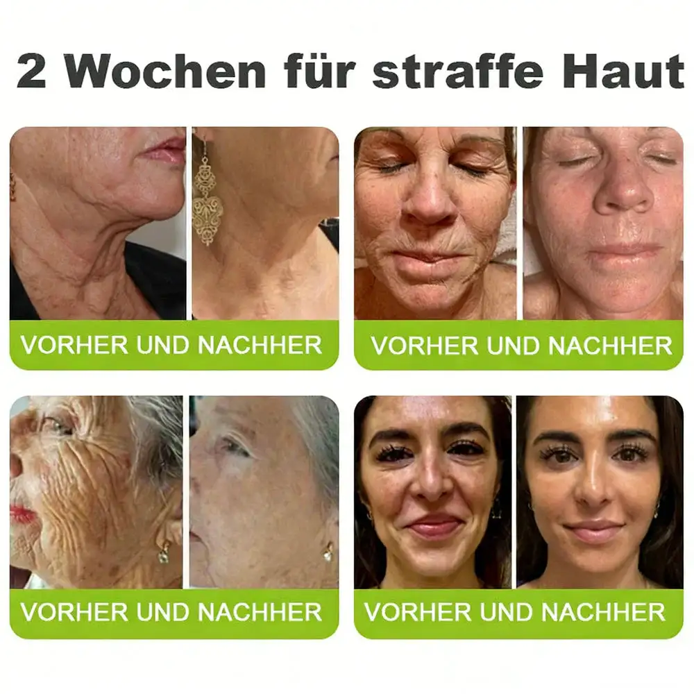 NESLEMY ™ Botox & Vita-A Retinol Shot Wrinkle Lift Firming Cream - Image 7