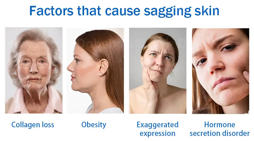 Sleeping V-Face Beauty Device - Image 2