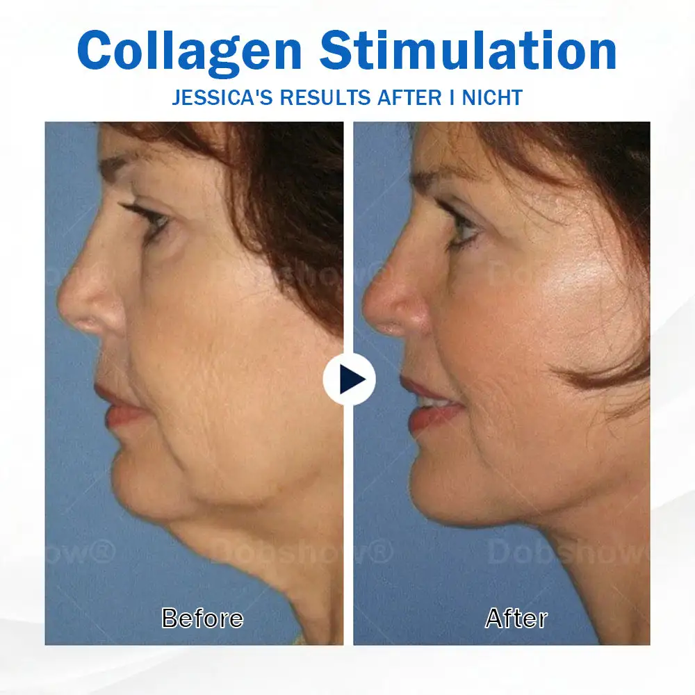Sleeping V-Face Beauty Device - Image 9