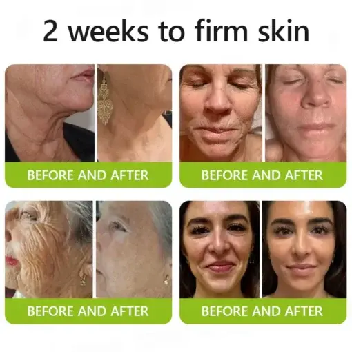 Botox Retinol Shot , FDA-Compliant Formula to Firm Sagging Skin Reduce Puffy Eyes - Image 4
