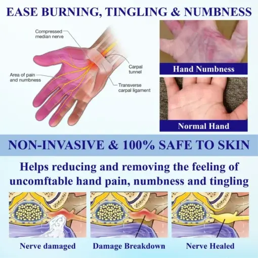 NumbAway CoolEase Neuropathy Spray - Image 5