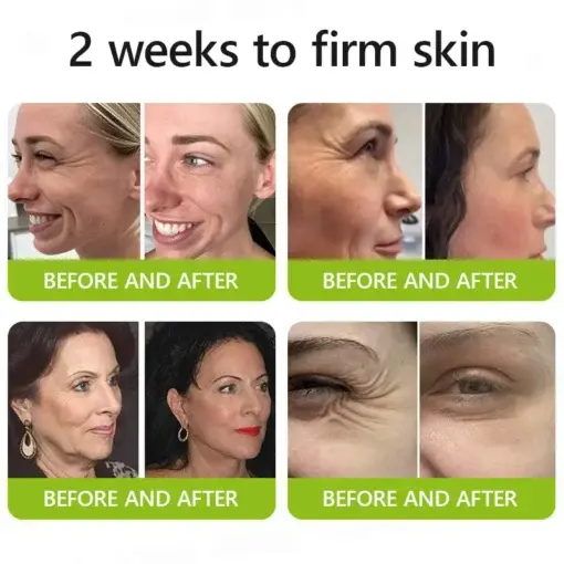 Peptide-Infused Firming Shot Dermatologist-Approved Formula for Powerful Lifting Visibly De-puffing - Image 4