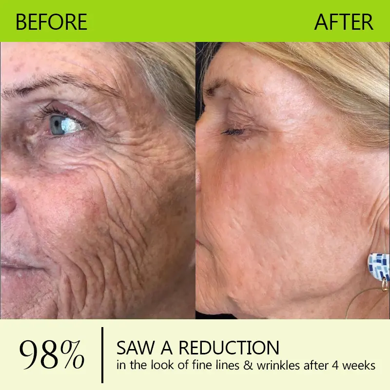 BOTOX & VITA A RETINOL SHOT Anti-Wrinkle Lifting & Firming Cream - Image 11