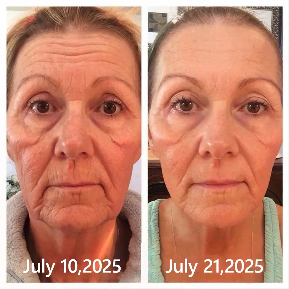 BOTOX & VITA A RETINOL SHOT Wrinkle Lift Tightening Cream - Image 41