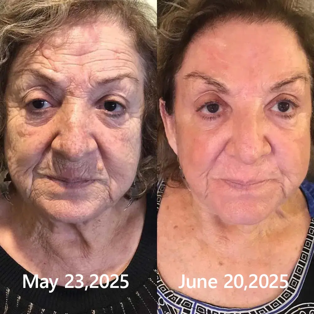 BOTOX & VITA A RETINOL SHOT Wrinkle Lift Tightening Cream - Image 43