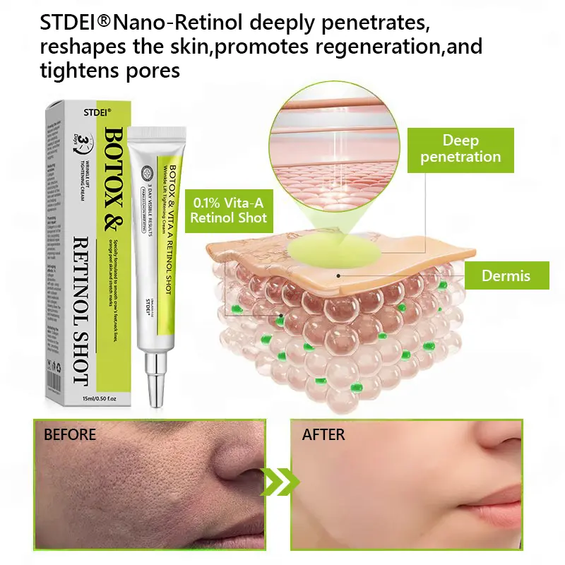 BOTOX & VITA A RETINOL SHOT Wrinkle Lift Tightening Cream - Image 50