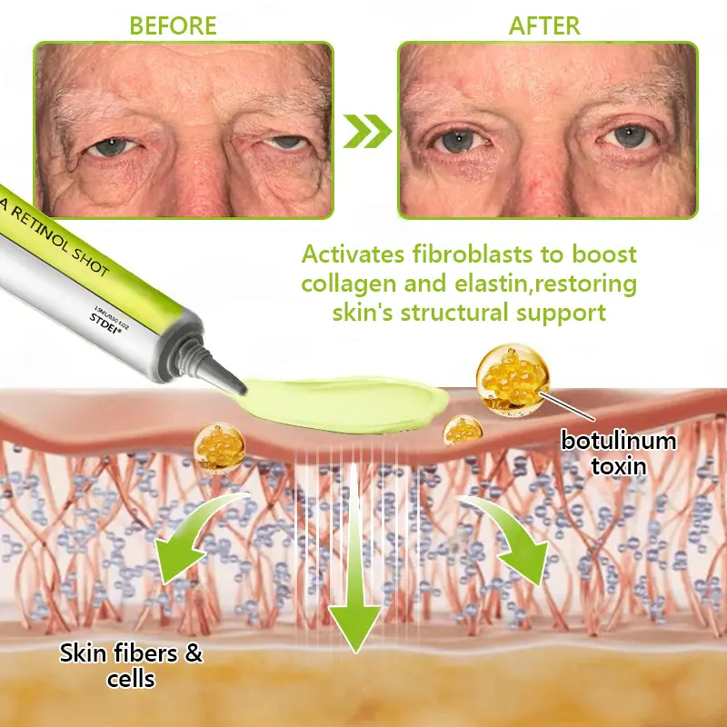 BOTOX & VITA A RETINOL SHOT Wrinkle Lift Tightening Cream - Image 51