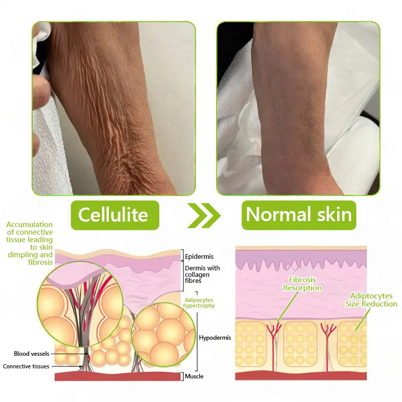 BOTOX & VITA A RETINOL SHOT Wrinkle Lift Tightening Cream - Image 53