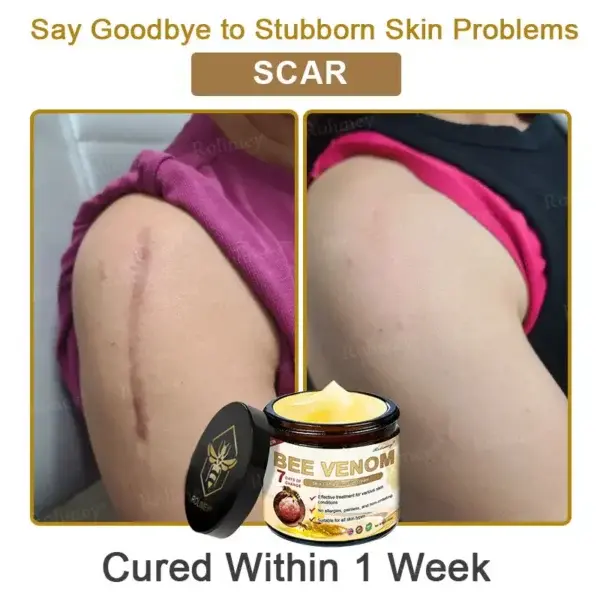 Bee Venom Skin Comprehensive Cream - Image 11