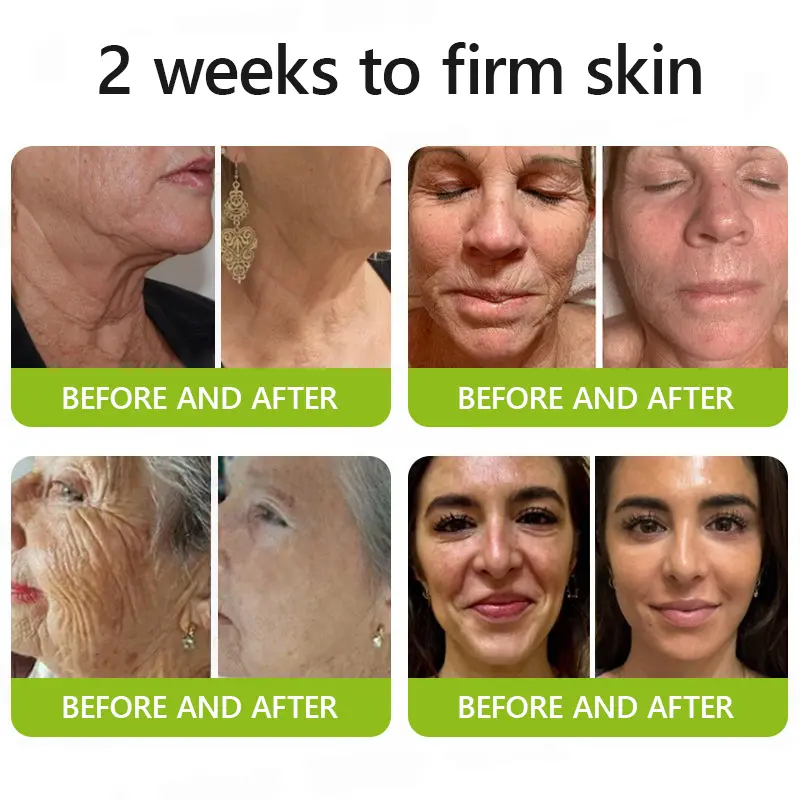 Botox & Vitamin A Retinol Shot Anti-Wrinkle Firming Cream - Image 4
