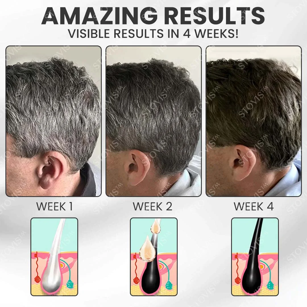 Beard & Hair Darkening Essence Spray - Image 3
