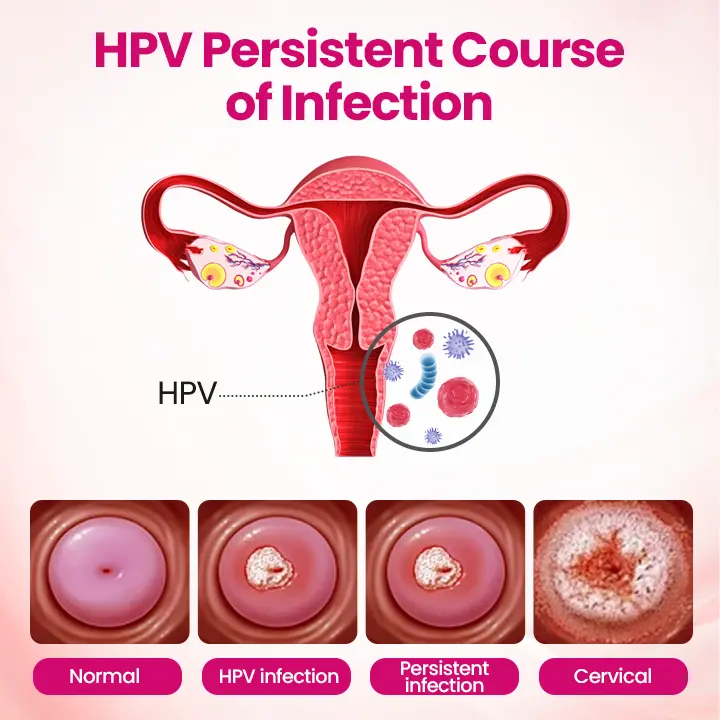 IntiDefend Anti-HPV Interferon Gel - Image 6