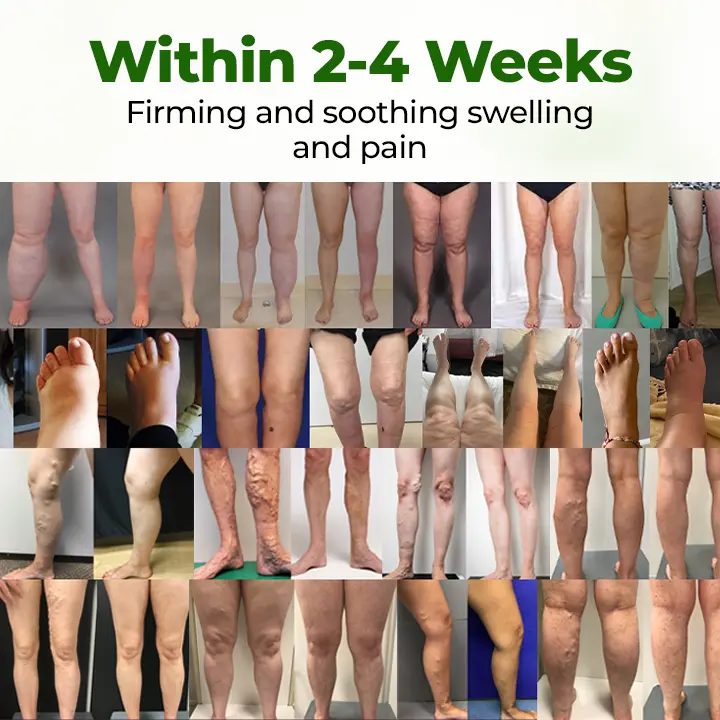 Professional Leg Circulation Cream - Image 2