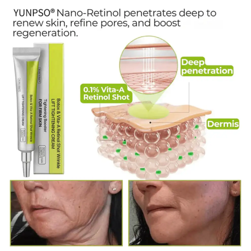 Advanced Peptide Botox-Style Vita-A Retinol Lifting Renewal Cream