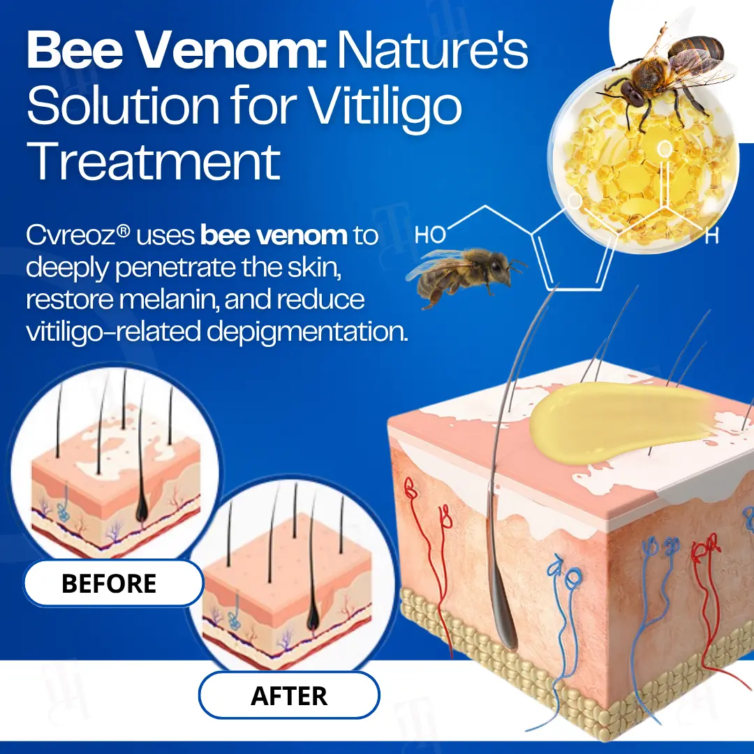 14 PCS Left - VitiClear Bee Venom Cream | No More Hiding that Skin!💕 - Image 5