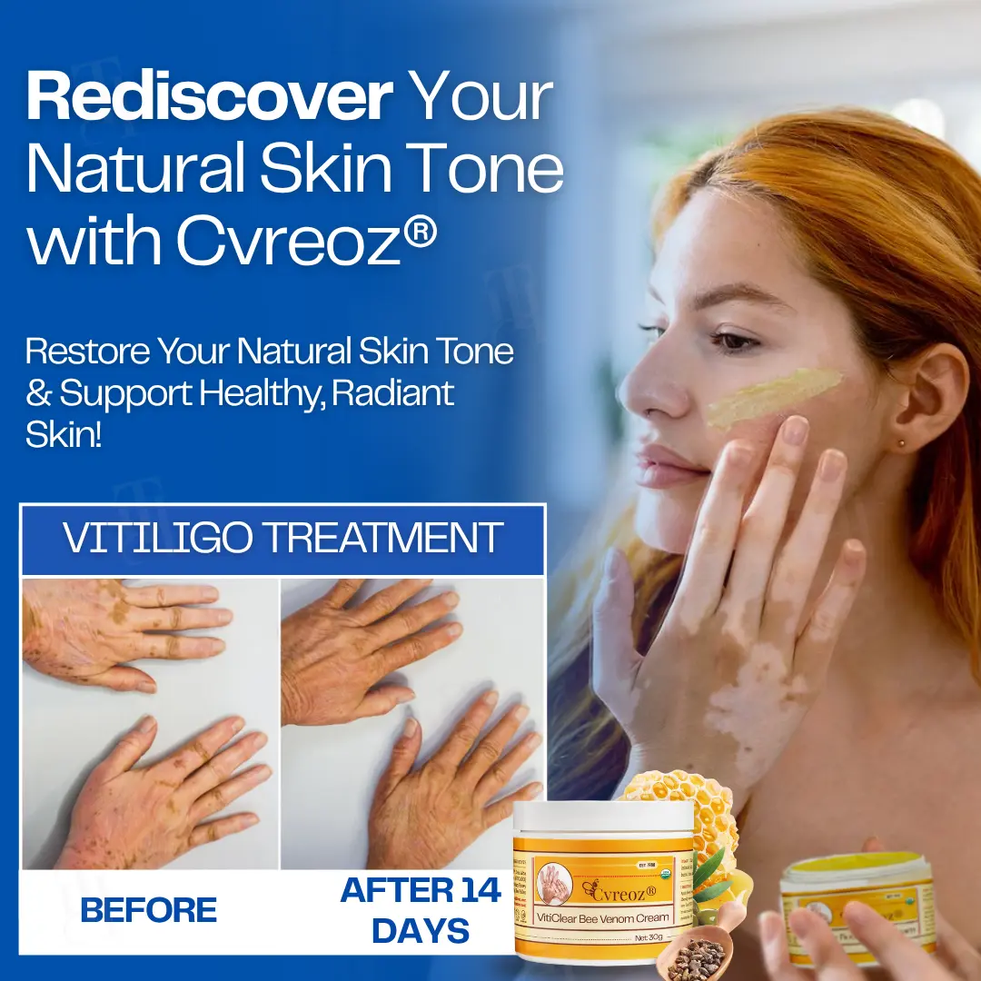 14 PCS Left - VitiClear Bee Venom Cream | No More Hiding that Skin!💕 - Image 7