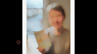 Fat Activating Microneedle Patches - Image 8