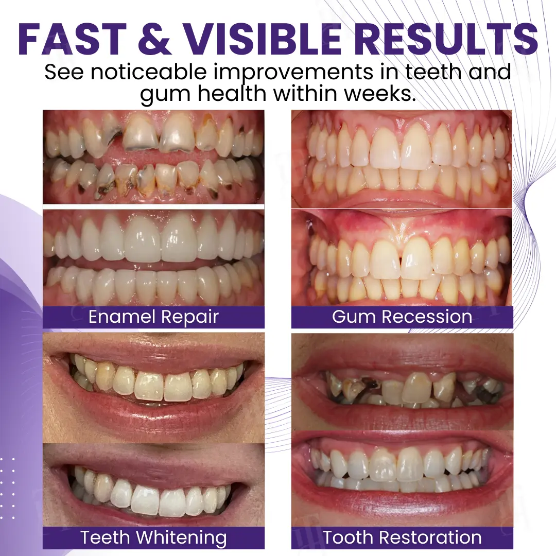 Smileagain Bee Venom Oral Treatment Powder - Image 2