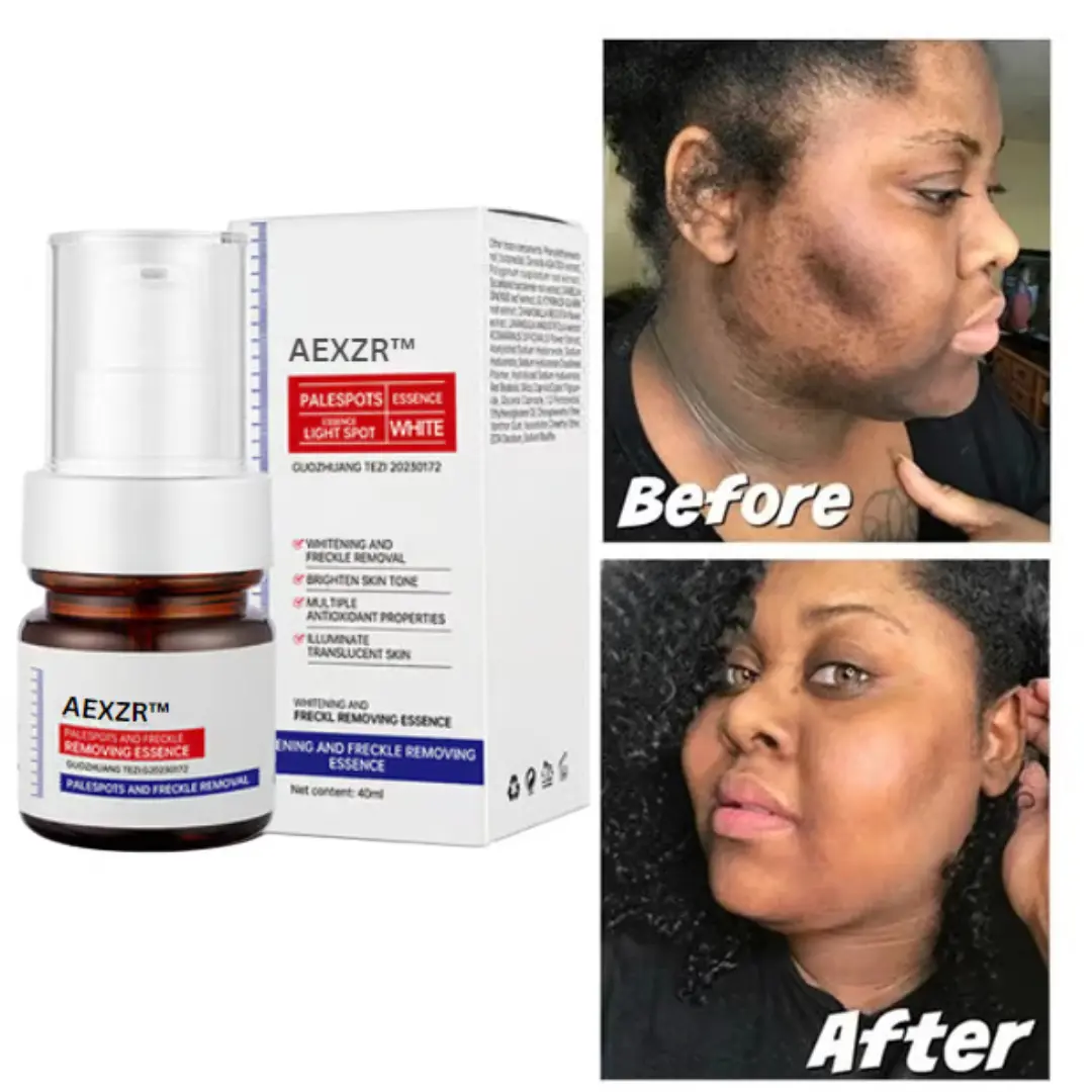 Vitamin C Whitening Freckles Face Cream Remove Melasma Dark Spots Lighten Melanin - Image 11