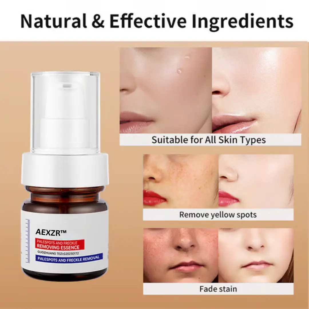 Vitamin C Whitening Freckles Face Cream Remove Melasma Dark Spots Lighten Melanin - Image 3