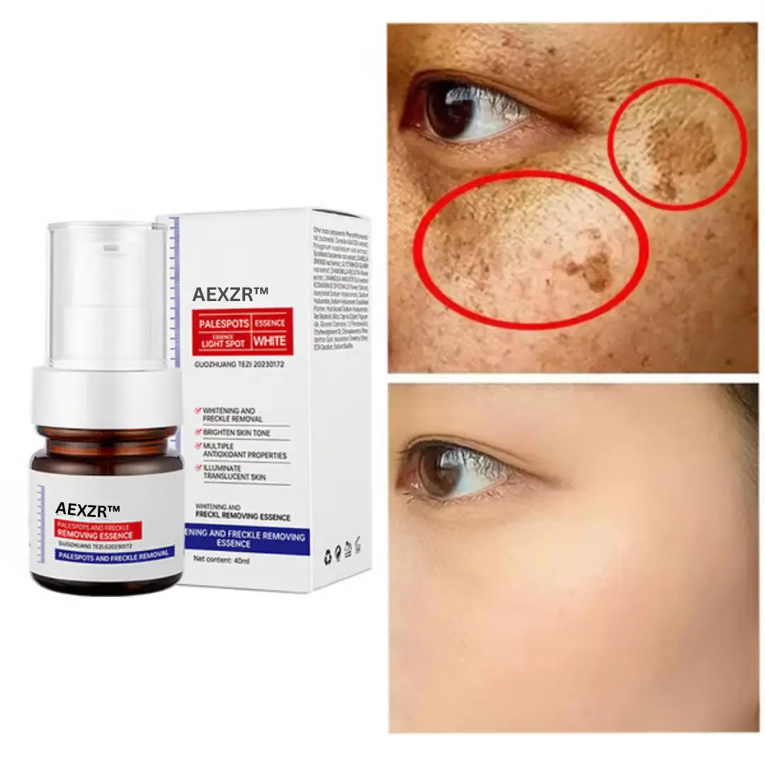 Vitamin C Whitening Freckles Face Cream Remove Melasma Dark Spots Lighten Melanin - Image 4