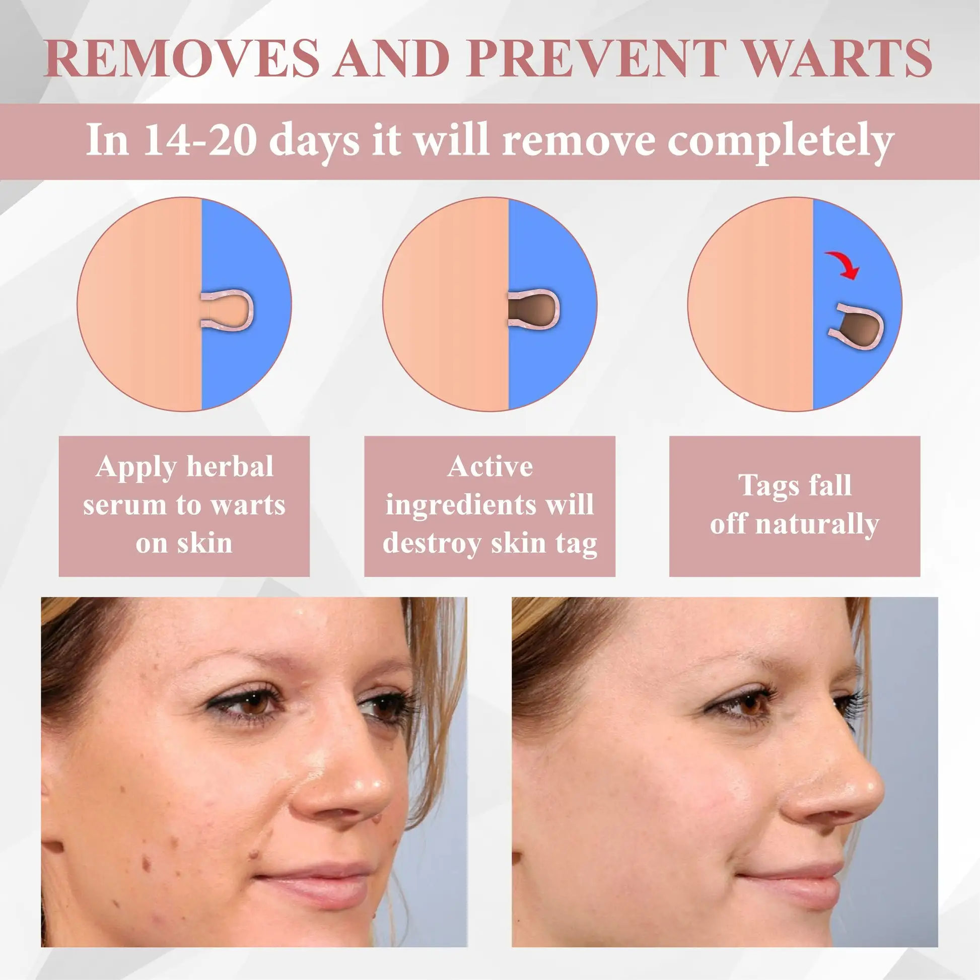 Tag & Blemish Peel-Off Gel Wrapping Mask - Image 10
