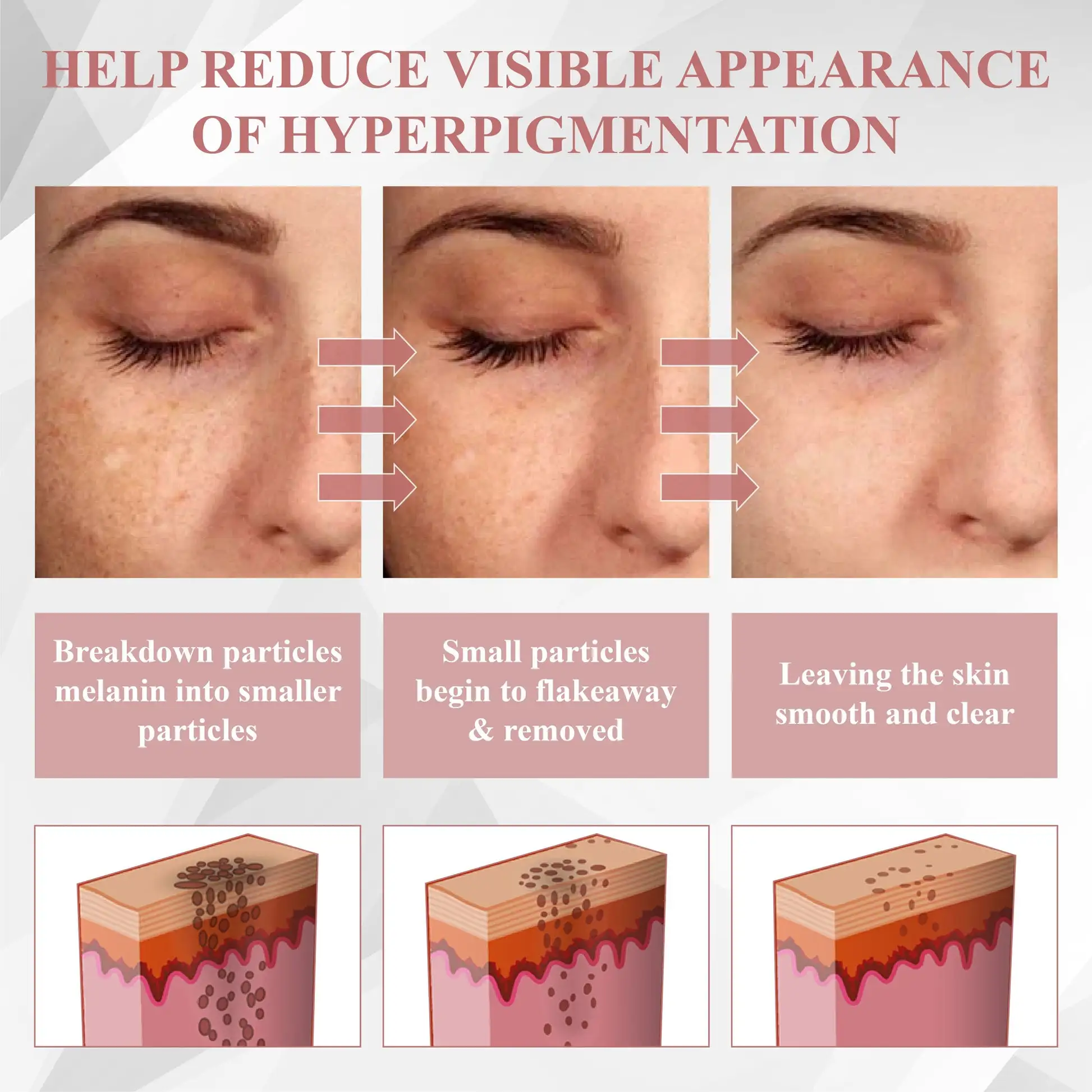 Tag & Blemish Peel-Off Gel Wrapping Mask - Image 8