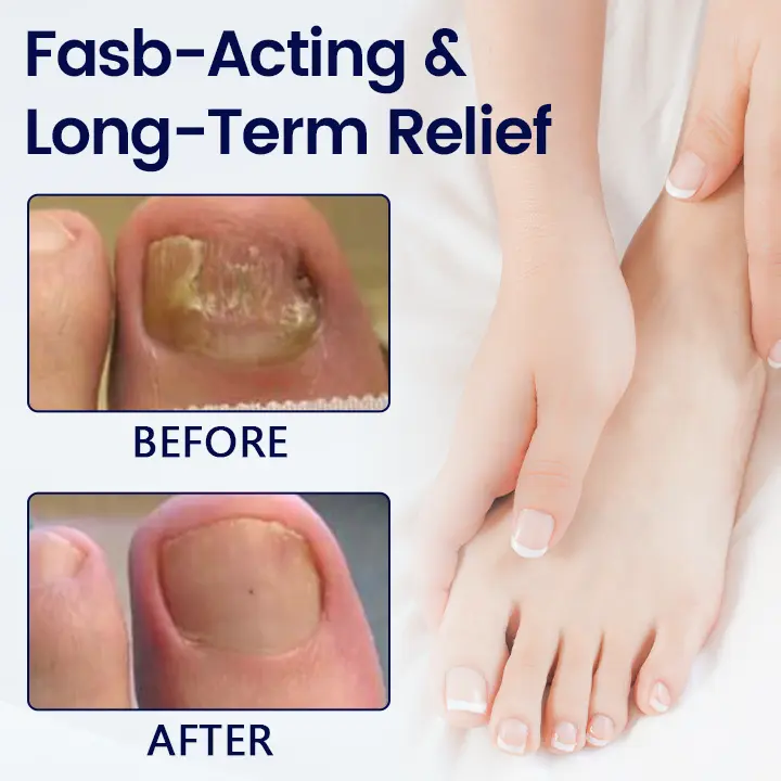 Anti-Fungal Nail Repair Patch - Image 4