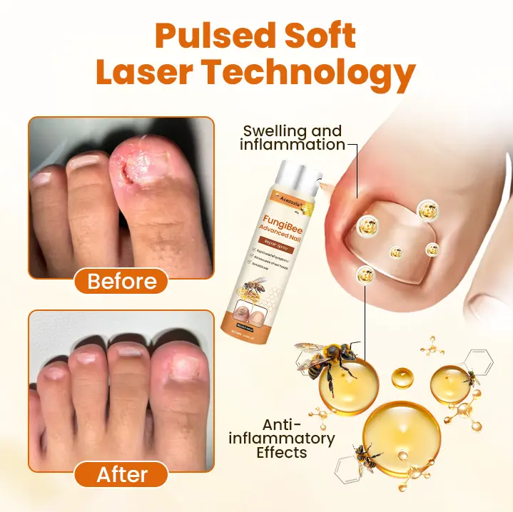 FungiBee Advanced Nail Repair Spray - Image 7