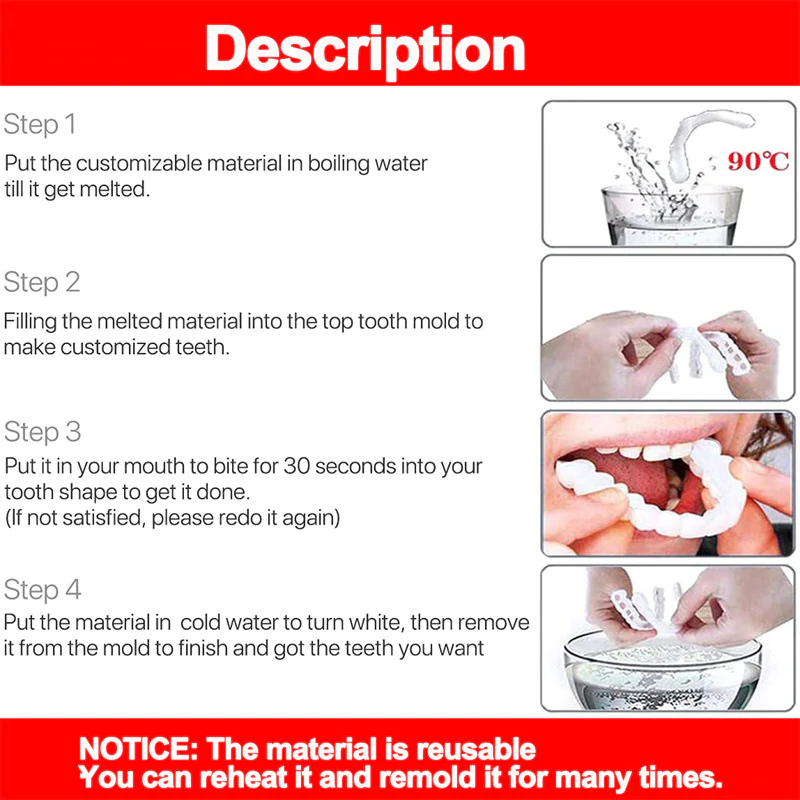Adjustable Snap-On Dentures - Image 4