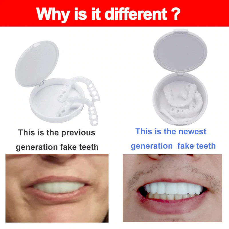 Adjustable Snap-On Dentures - Image 5