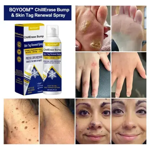 Bump & Skin Tag Renewal Spray - Image 2