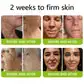 BOTOX & VITA A RETINOL SHOT Wrinkle Lift Tightening Cream - Image 31